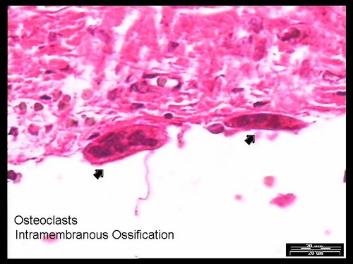 i-3de60cfa7e330db317d0ab7a8c70d682-6-Osteoclasts - Intramembranous Ossification-thumb-500x375.jpg